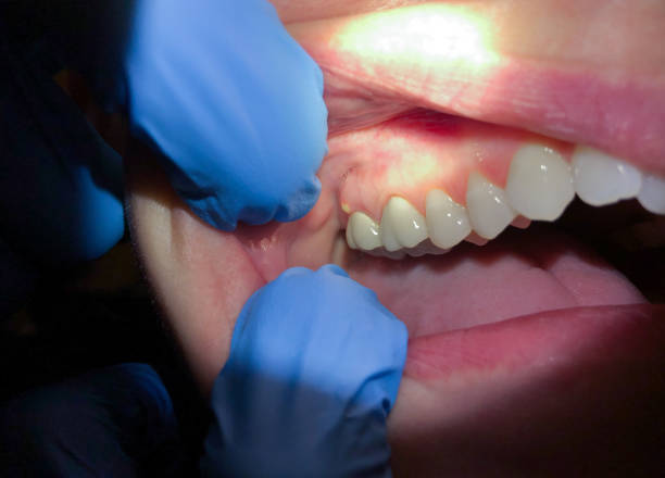 Best Emergency Gum Pain Relief  in Deer Park, OH