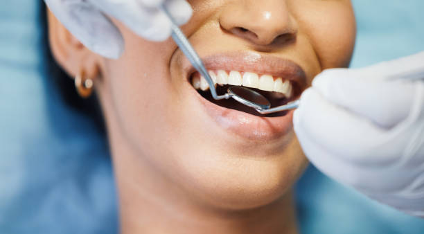 Teeth Whitening in OH